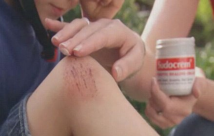 Sudocrem Skin Care Cream: Review Sudocrem Skin Care Cream: Review